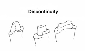 discontinuity 