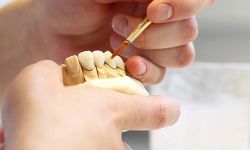 Hand crafting teeth to illustrate the material and techniques used by this smile design dental lab