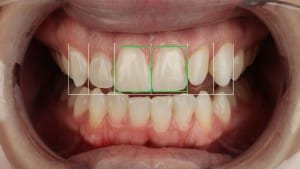 Dental Lab Tips